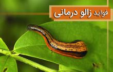 زالو درمانی دریچه جدید طب نوین /متخصصین زالو درمانی در ایران تربیت شود